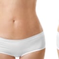 A Comprehensive Look at Ultrasound-Assisted Liposuction (UAL): Improving Your Body Shape Without Surgery