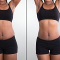 LipoDissolve: The Non-Surgical Solution for a Slimmer You