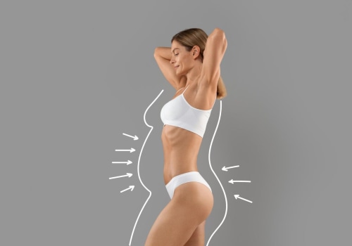 Satisfied Patient Stories: How Smart Lipo Can Help You Achieve Your Desired Results