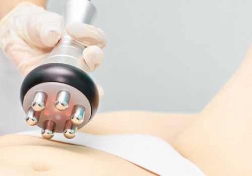 Understanding Vaser Liposuction: The Non-Surgical Alternative to Achieve Your Dream Body