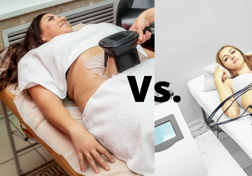 Which is more effective laser lipo or fat freezing?